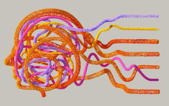 Cover image for Why too much dopamine is killing your motivation